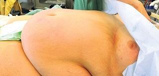 Schlank werden ohne hungern