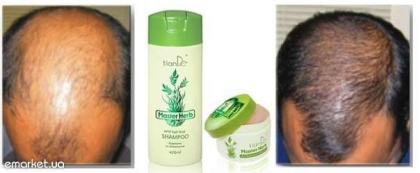 Creme-Balsam gegen Haarausfall Master Herb von TianDe Natur-Kosmetik