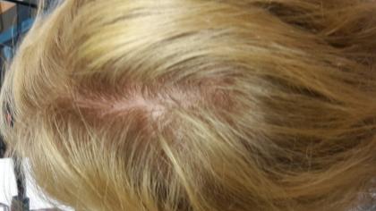 Deine Haar ` Krone ` strahlt mit natürlicher Schönheit. Dein Körper leuchtet in 